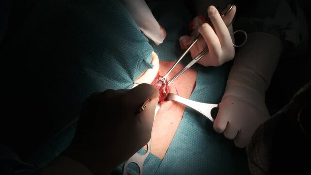 Crop surgeons performing thyroid gland removal surgery on patient