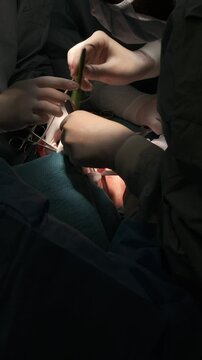 Surgeons performing thyroid gland removal surgery on patient. Vertical orientation
