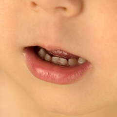 Fototapeta premium open child's mouth, short teeth with gaps in drool, puddle of drool in mouth