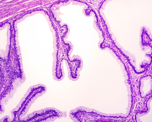 Prostate glands