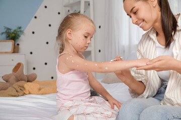 Mother smearing her little daughter ill with chickenpox in bedroom