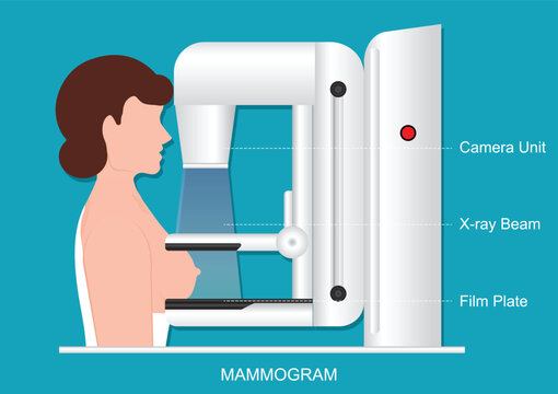Mammography also called mastography DICOM modality or MG.