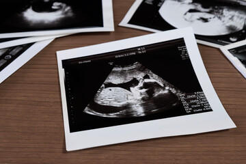 机に置かれたエコー写真