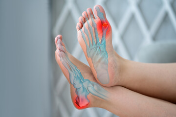 Joint diseases, hallux valgus, plantar fasciitis, heel spur, woman's leg hurts, pain in the foot,...