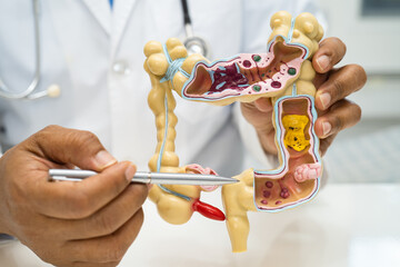 Intestine, appendix and digestive system, doctor holding anatomy model for study diagnosis and...