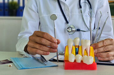 Dentist holding tooth model during consultation on dental implant surgery in dental clinic concept