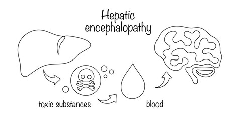 Hepatic encephalopathy