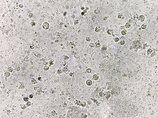 Microscopic view of stool sample showing Cyst of Entamoeba histolytica, Medical and health care concept