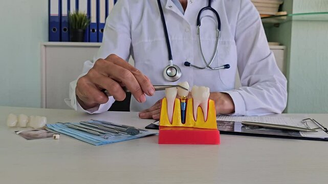 Doctor hold dental implant, artificial tooth roots into jaw, root canal of dental treatment, gum disease