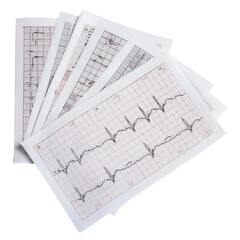 ECG results on paper