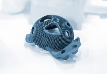Implant of joint printed on a 3D printer from biocompatible titanium. Individual 3D-handled...
