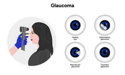 Ophthalmology eye testing. Pneumotonometer. Inflammatory glaucoma. Neovascular glaucoma. Traumatic glaucoma