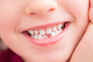Obraz premium Health care and dental hygiene concept. Close up portrait of little girl without milk teeth.