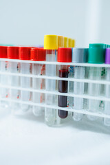 Test tubes with blood. Taking blood from a vein for research