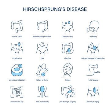 hirschsprungs_disease_icons_blue