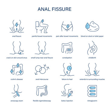 Anal Fissure symptoms, diagnostic and treatment vector icon set. Medical icons.	