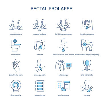 Rectal Prolapse symptoms, diagnostic and treatment vector icon set. Medical icons.	