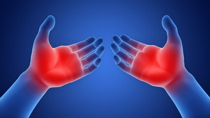 Human Suffering with Severe Pain in Palm Hands Anatomy