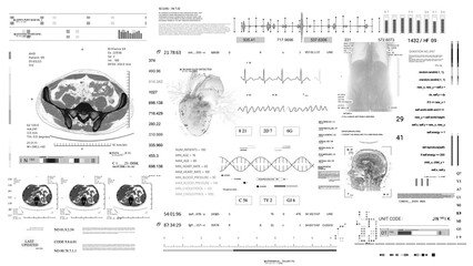 MRI x ray CT Scan.Heart rate monitor Medical HUD monitoring. Futuristic Technological Interface. Sceleton, 3D Model.Healthcare.white