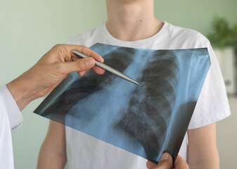 x ray thorax,doctor looks at the picture in the hospital for pneumonia and cancer concept