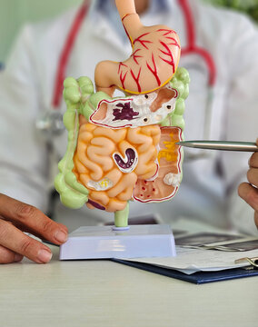 Doctor with digestive system in clinic.