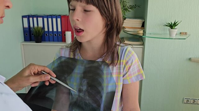 Doctor looks at x-ray of lungs with pneumonitis