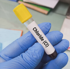 Blood sample for chloride (Cl) test