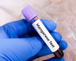 Blood sample for Manganese (Mn) test, to evaluate central nervous system, blood toxicity test....
