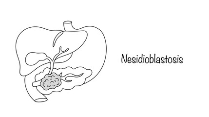 Nesidioblastosis