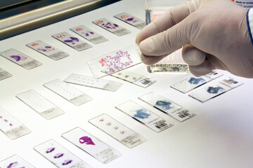 Hands of laboratory assistant holding a petri plate; Laboratory glassware, science laboratory...