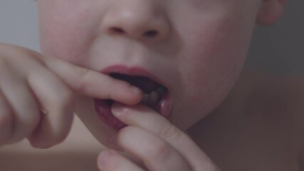 Boy stands with his mouth open showcasing loose milk tooth in close-up shot milk teeth growth. Close-up of boy displaying wobbly milk tooth with open mouth childhood moments milk teeth