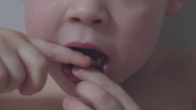 Boy stands with his mouth open showcasing loose milk tooth in close-up shot milk teeth growth. Close-up of boy displaying wobbly milk tooth with open mouth childhood moments milk teeth
