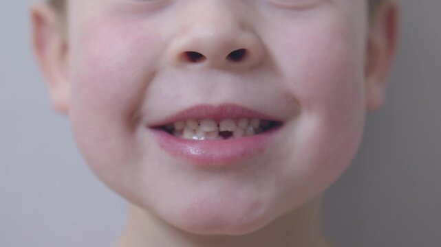Child stands with open mouth showing missing milk tooth carefree spirit of childhood and natural process of growing up. Close-up of boy face with open mouth showcasing his lost milk tooth