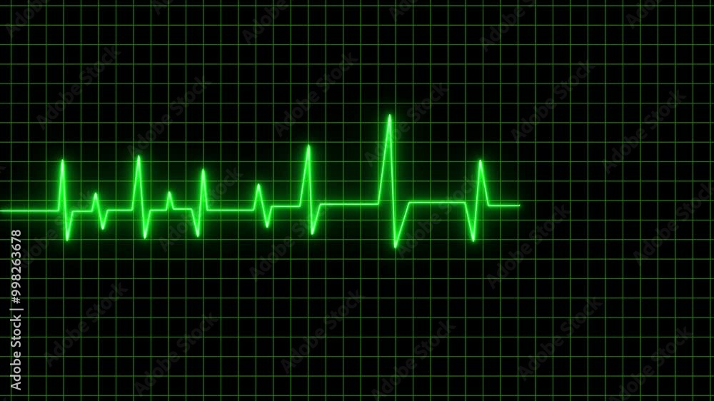 Poster heart pulse loop motion neon with grid effects on black bg. heart rate animation neon heart beat ecg