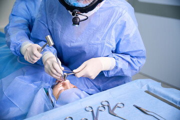 Surgery to straighten a deviated nasal septum