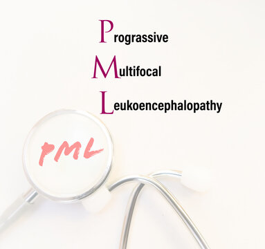 Progressive Multifocal Leukoencephalopathy (PML) is a disease of the white matter of the brain, caused by a virus infection (polyomavirus JC)