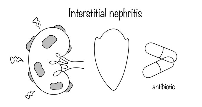 Interstitial nephritis
