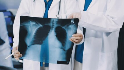 Medical team examining an x-ray in a hospital - Powered by Adobe