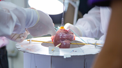 A team of surgeons are practicing artificial heart valve replacement surgery. Sutures are placed...