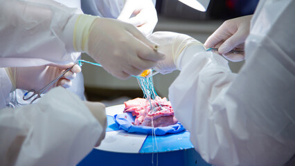A team of surgeons are practicing artificial heart valve replacement surgery. Sutures are placed...