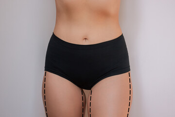 Cropped shot of a young woman with excess fat with marks for liposuction or plastic surgery on her...