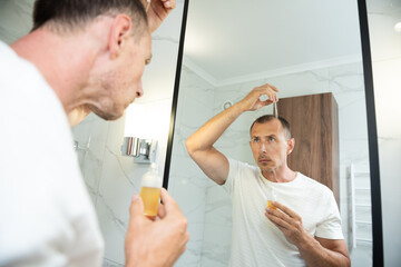 Hair loss person with serum peptide or minoxidil. Balding man head close-up. Hairloss and alopecia concept