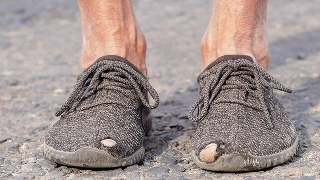 Poverty. Old shoes with hole and toes sticking out.