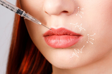 Contour plastic lip augmentation and skin treatment concept.