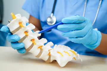 Asian doctor holding spinal nerve and bone model, Lumbar spine displaced herniated disc fragment...