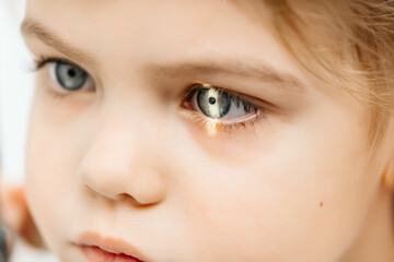 In a modern ophthalmology clinic, an ophthalmologist checks a little girl's vision using a...