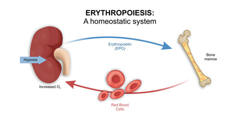 Erythropoiesis: A homeostatic system, Anemia in chronic kidney disease