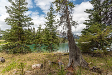 Stunning scenes around Beauvert Lake in Jasper National Park with incredible beautiful colours in water surrounding the popular area of the Canadian Rockies, Canada.