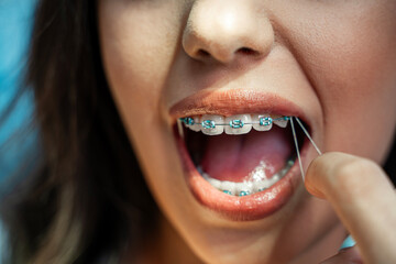 Frontal closeup shot, young woman putting rubber band on dental brackets with her finger