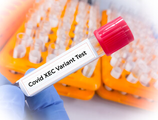 Blood sample for Omicron Sub-variant KS.1.1 and KP.3.3 test, Covid XEC Variant